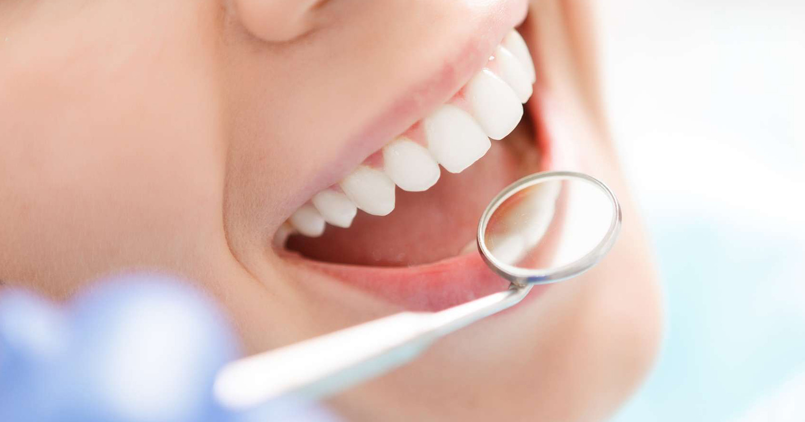alldental
