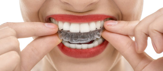orthodontie solutions invisibles